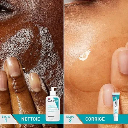 cerave anti imperfection